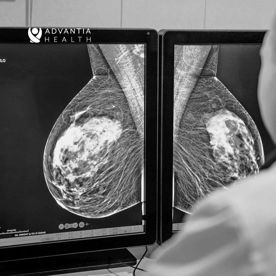 Advances in Imaging Technology: Improving Mammogram Accuracy